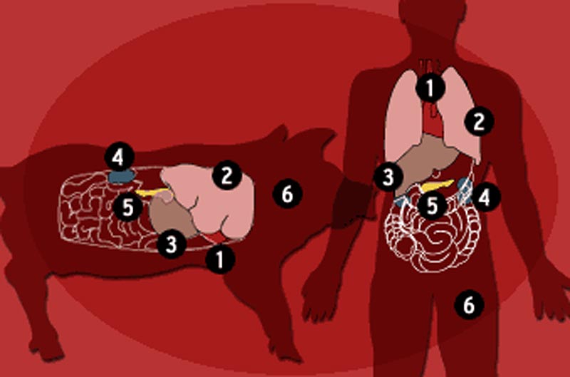 Human-Pig-Transplant