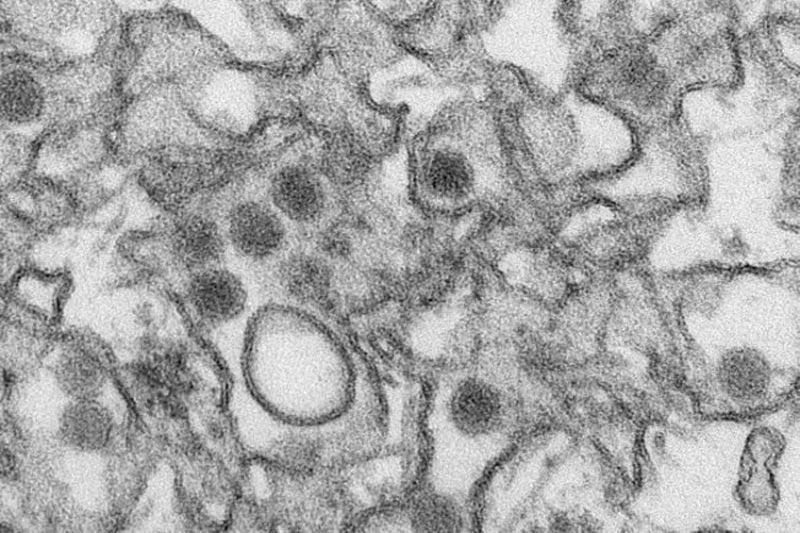 Virus-Zika-1