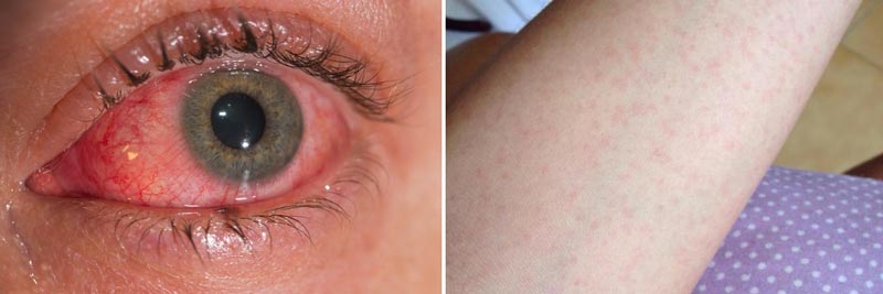 Virus-Zika-2