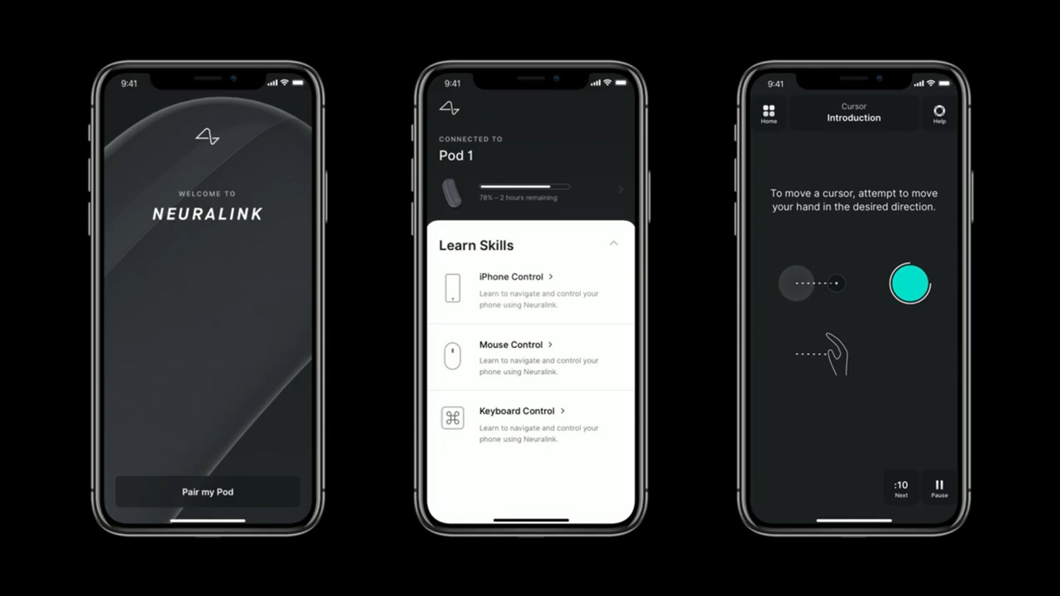 Neuralink