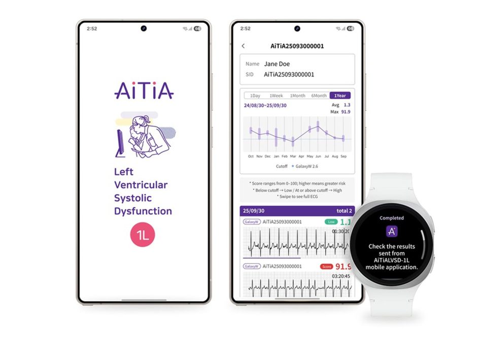 Samsung Bangunkan Pengesan Disfungsi Sistolik Ventrikel Kiri (LVSD) Pertama Untuk Jam Pintar 1 Samsung LVSD Left Ventricular Systolic Dysfunction jantung