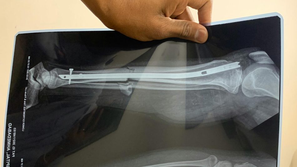 pratik patel dgkMfwX 45w unsplash